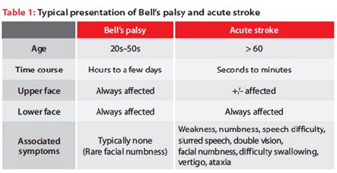 Bells Palsy Vs Stroke How To Distinguish Them New Health Advisor