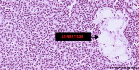 parathyroid-2-slide-labelled-histology - Schoolworkhelper | Upload ...