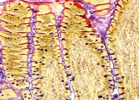 PAS Stained Duodenal Villi – Collection of Histology Images