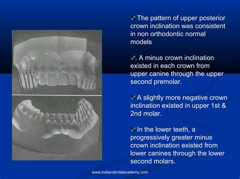 Andrews Six Keys Of Occlusion Certified Fixed Orthodontics Courses In