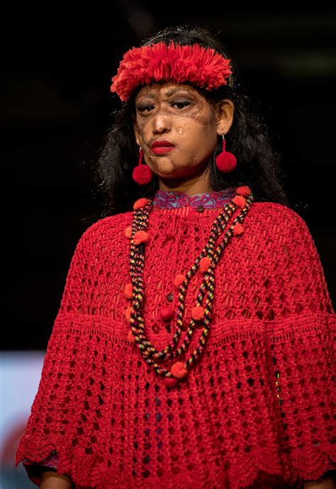 These Acid Attack Survivors Walking The Runway Will Inspire You To Join Their Fight