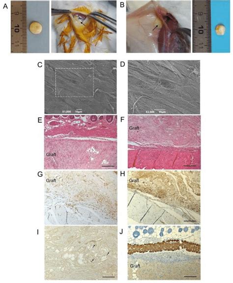 Decellularized Human Diaphragm Integration In Host Tissue A