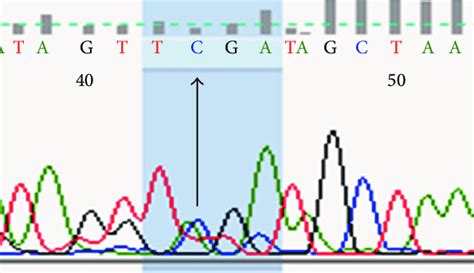 DNA sequencing of AC genotype patient. | Download Scientific Diagram