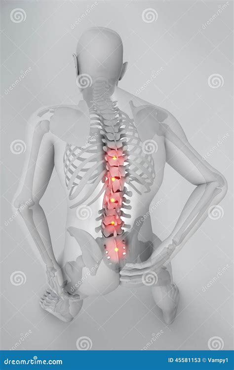 Spina Dorsale Dello Scheletro Dei Raggi X Di Dolore Di Mal Di Schiena
