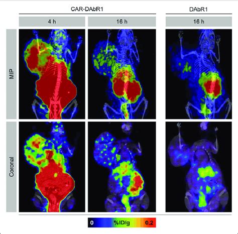 In Vivo Tracking Of Adoptively Transferred T Cells With Pet