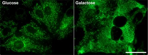 Mitochondrial ATP Depletion Disrupts Caco 2 Monolayer Integrity And