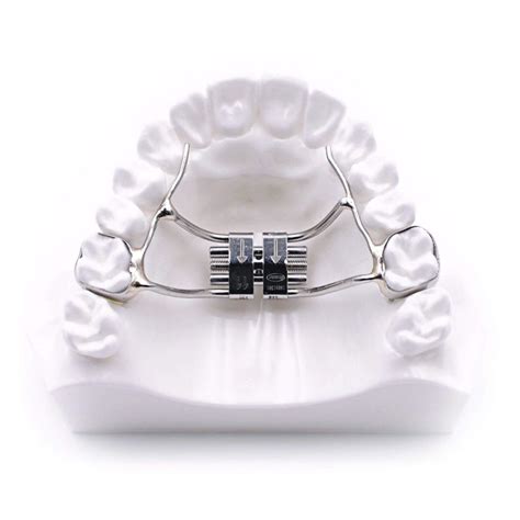 Everything You Need To Know About Palatal Expanders