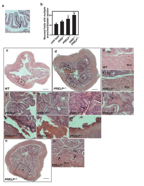 Prelp Knockout Mice Spontaneously Initiate Early Stages Of Bladder