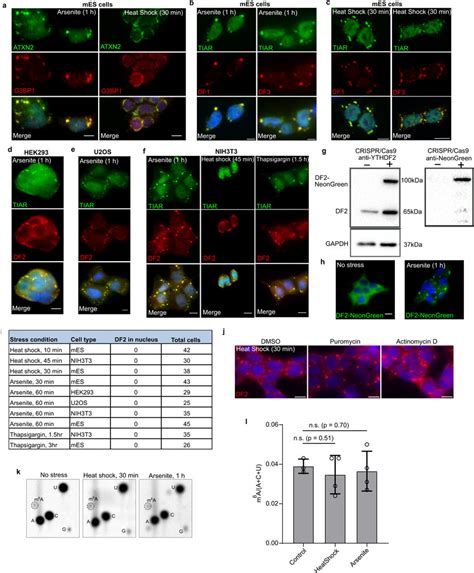 Assessing Which Stressors Induce Stress Granules And The Localization