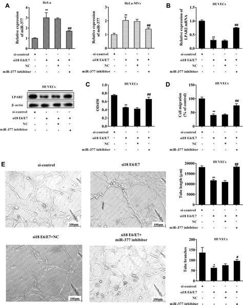 Interfering E E Inhibited Angiogenesis Of Huvecs Via Increasing