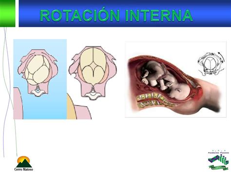 Ppt Cuidados De Enfermeria En El Trabajo De Parto Y Parto Powerpoint