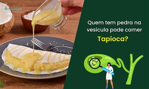 Quem Fez Cirurgia De Vesícula Pode Comer Tapioca