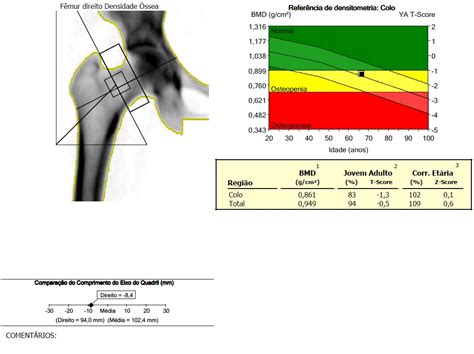 aula 5 Como realizar um exame de densitometria óssea verloop io