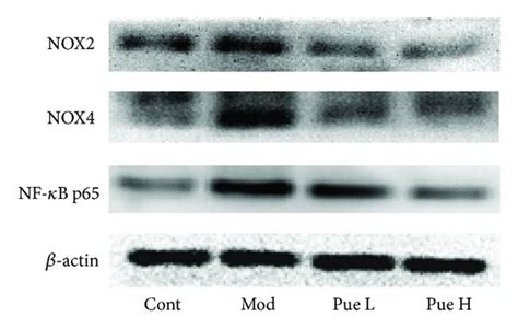 Effect Of Puerarin On Protein Expression Of Nox Nox And Nf B P