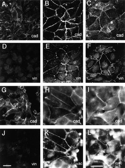 Colocalization Of Vinculin Or Actinin With E Cadherin A And D