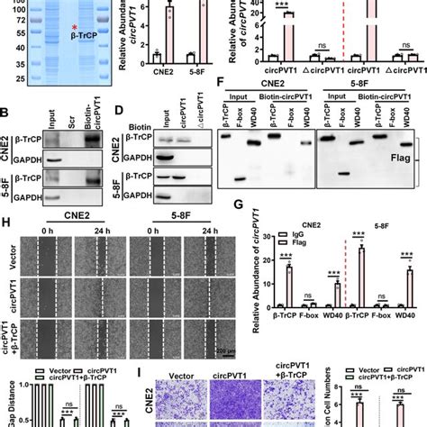 Circpvt Promotes The Migration And Invasion Of Npc Cells By Regulating