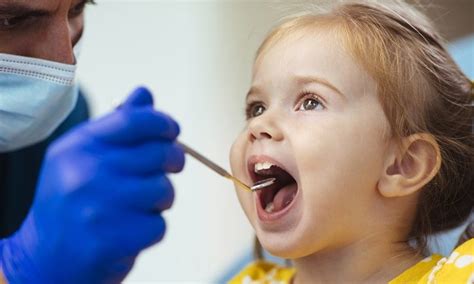 Cavities in Kids: Causes, Symptoms & Prevention - FOKP