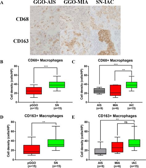 Assessment Of Cd68 Tumor Associated Macrophages Tams And Download Scientific Diagram