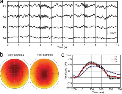 Table 1 From Hemodynamic Cerebral Correlates Of Sleep Spindles During