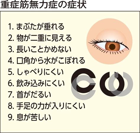 重症筋無力症に新薬難治性もコントロール可能に｜医療ニュース トピックス｜時事メディカル｜時事通信の医療ニュースサイト