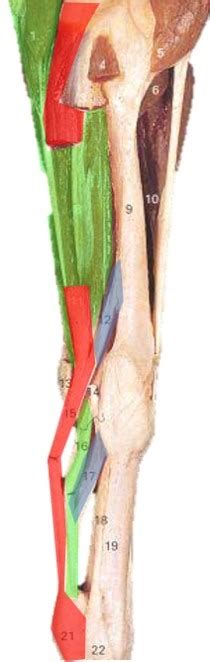 Anatomy: Equine carpal and digital flexors (L5) Diagram | Quizlet