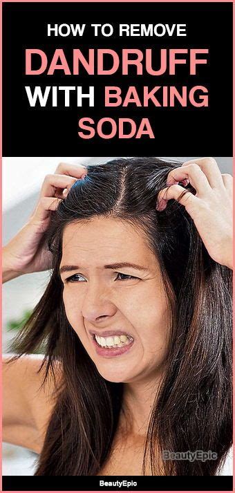 How To Remove Dandruff With Baking Soda Baking Soda For Dandruff