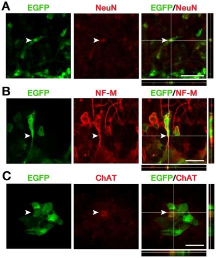 Confocal Microscopy Analysis Of Mnim Eoh Cells Green Immunostained