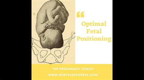 Optimal Fetal Positioning Youtube