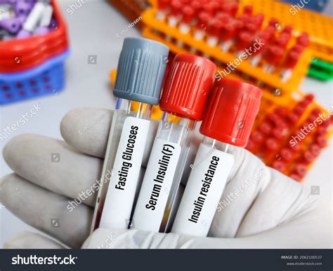 Fasting Blood Sugar Over 701 Royalty Free Licensable Stock Photos