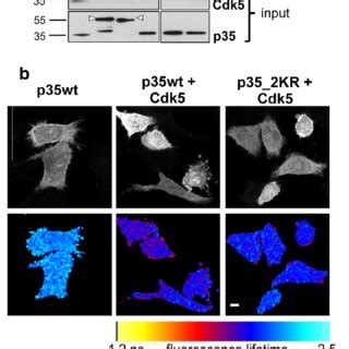 Cell Cycle And Dna Damage Dependent Sumoylation Of Pcna A Hispol