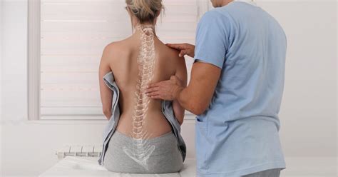 Severe Scoliosis Before And After