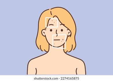 Naked Woman Red Pimples On Face Stock Vector Royalty Free