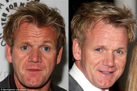 Smooth Operator Has Tv Chef Gordon Ramsay Had Botox Daily Mail Online