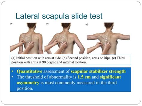 Scapular Dyskinesis Ppt