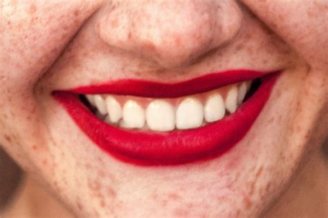 Dicas Para Ter Uns Dentes Bonitos E Saud Veis