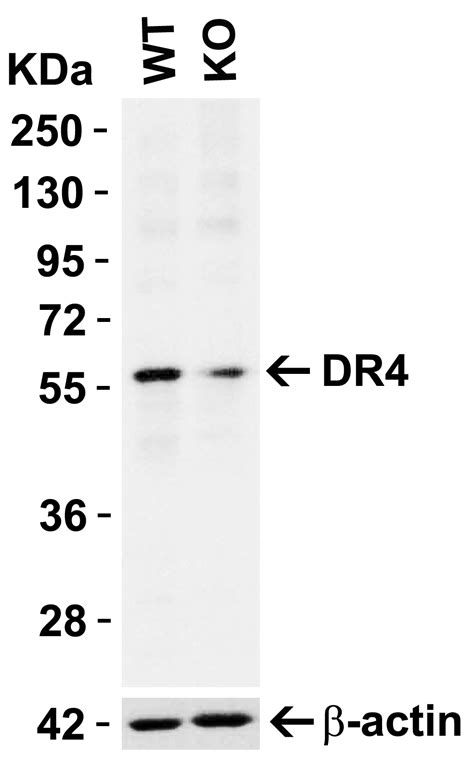 Anti Dr Nt Antibody Qed Bioscience Inc