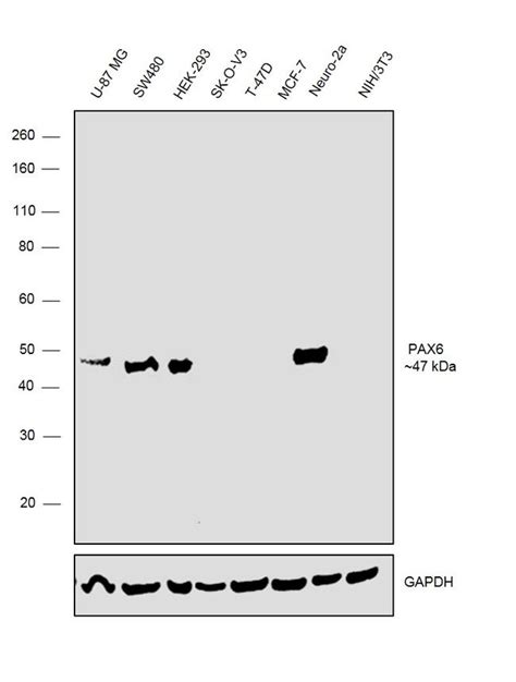 Pax6 Recombinant Monoclonal Antibody Sd08 31 Ma5 32409