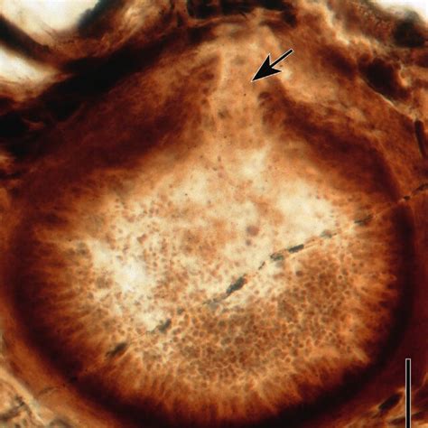 2 Life Cycle Of A Typical Ascomycete From Taylor Tn Et Al 2009 Download Scientific