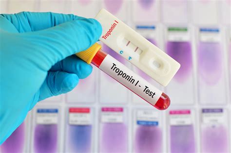 Reassessing The Upper Limit Of Normal In High Sensitivity Cardiac