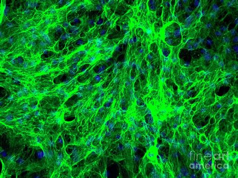 Perineurial Fibroblast Cells Photograph By Daniel Schroen Cell