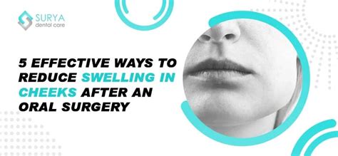 5 Effective Ways To Reduce Post Operative Swollen Cheek Surya Dental Care