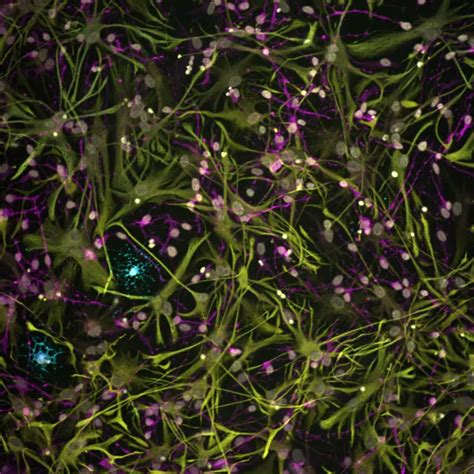 Glia Cells From Primary Progre Image Eurekalert Science News Releases