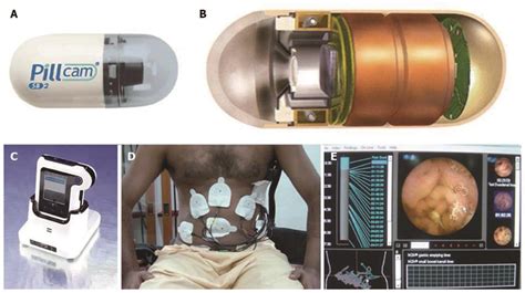 Capsule Endoscopy Uses, Side Effects, And Results, 40% OFF