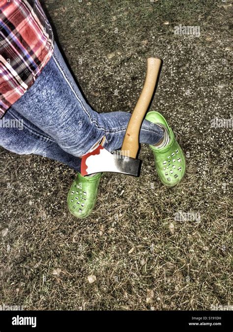 Ax en la pata de la persona Fotografía de stock Alamy