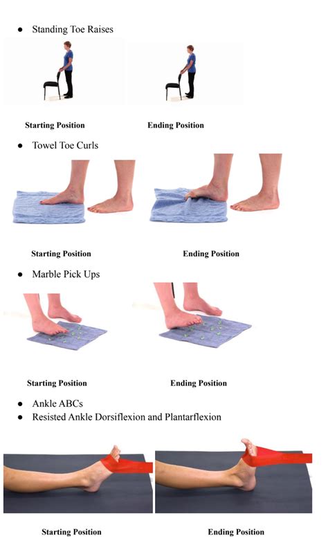 Foot Drop (Drop Foot) Treatment | Peroneal Nerve Injury