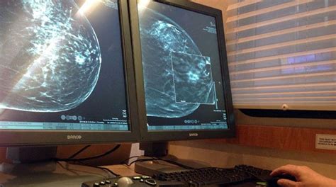 3 D Mammograms See Breast Tissue Better Fox News