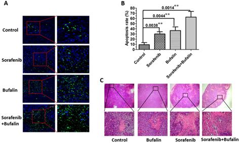 Synergistic Anticancer Effects Of Bufalin And Sorafenib By Regulating