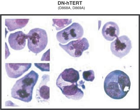 Microscopic Appearance Of Clones 2 And 3 Of K562 Cells Transduced With Download Scientific