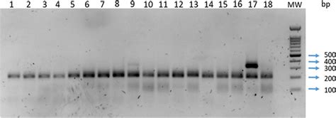 A 1 5 Agarose Gel Obtained From The Amplification Of 18 Download