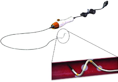 Symplicity Spyral™ Renal Denervation Catheter Photo Adopted From Download Scientific Diagram